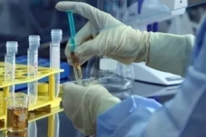 Imunološki zavod i dalje paraliziran zbog štrajka