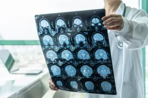 neurologija studij
